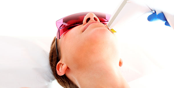 FOTOREJUVENECIMIENTO FACIAL LUZ PULSADA INTENSA IPL