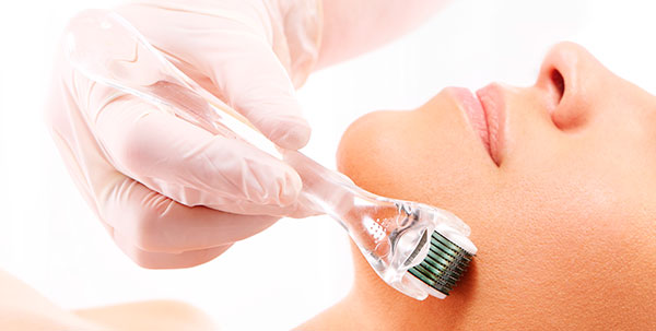 REJUVENECIMIENTO FACIAL MEXICO SKIN NEEDLING